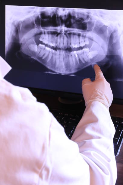 Best Emergency Dental Care for Sports Injuries in Gilbertsville, PA